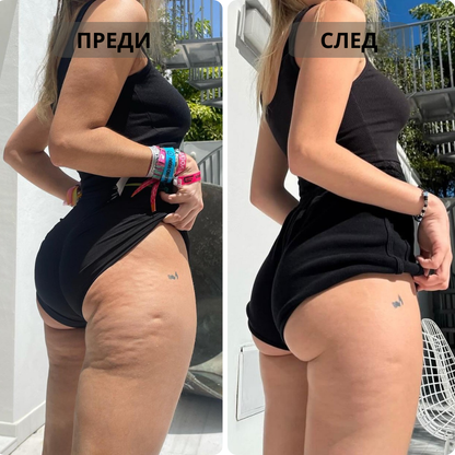 Therma® - Вендузен Масажор с Топлина и Червена Светлина